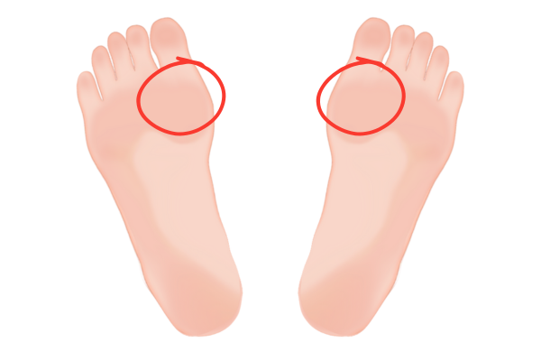 母指球の説明画像